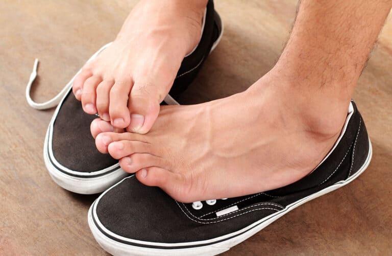 5 besten Tipps um Fußpilz zu vermeiden